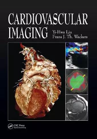 Cardiovascular Imaging cover