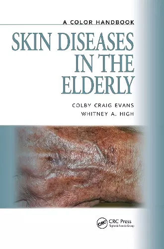 Skin Diseases in the Elderly cover