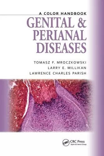 Genital and Perianal Diseases cover