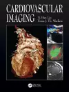 Cardiovascular Imaging cover