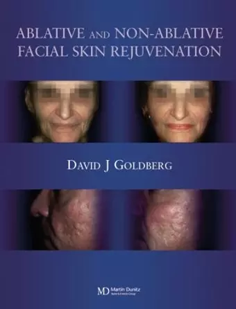 Ablative and Non-ablative Facial Skin Rejuvenation cover