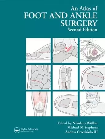 Atlas Foot and Ankle Surgery cover