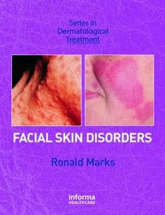 Facial Skin Disorders cover