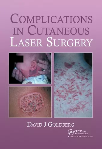Complications in Laser Cutaneous Surgery cover