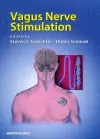 Vagus Nerve Stimulation cover