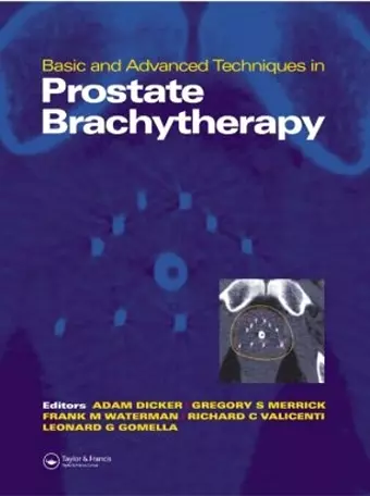 Basic and Advanced Techniques in Prostate Brachytherapy cover