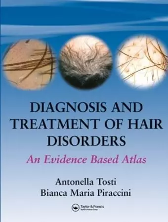 Diagnosis and Treatment of Hair Disorders cover