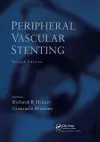 Peripheral Vascular Stenting, Second Edition cover