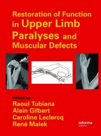 Restoration of Function in Upper Limb Paralyses and Muscular Defects cover