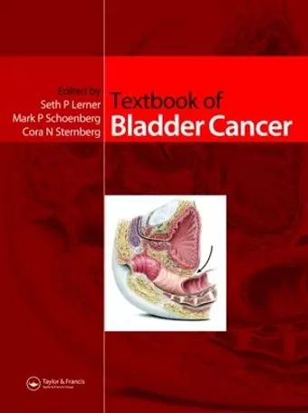 Textbook of Bladder Cancer cover