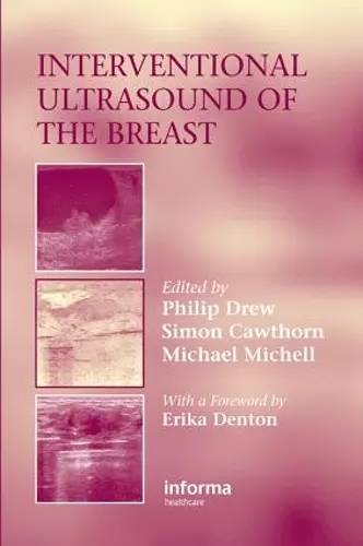 Interventional Ultrasound of the Breast cover