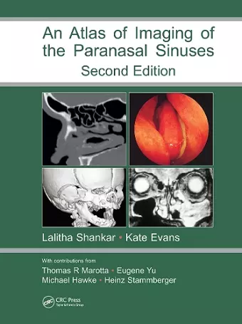 Atlas of Imaging of the Paranasal Sinuses, Second Edition cover