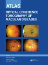 Atlas of Optical Coherence Tomography of Macular Diseases cover