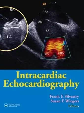 Intracardiac Echocardiography cover