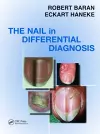 Nail in Differential Diagnosis cover