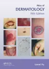 Atlas of Dermatology, Fifth Edition cover