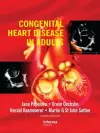 Congenital Heart Disease in Adults cover