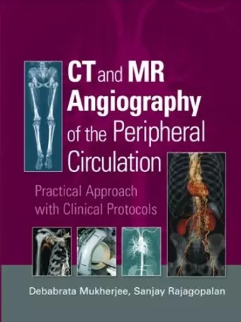 CT and MR Angiography of the Peripheral Circulation cover