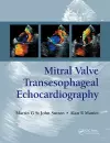 Mitral Valve Transesophageal Echocardiography cover