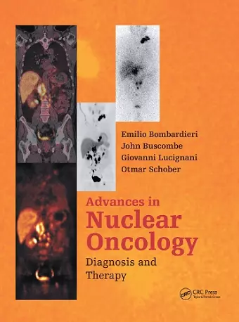 Advances in Nuclear Oncology cover