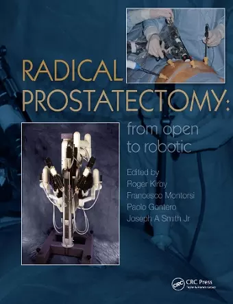 Radical Prostatectomy cover