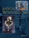 Radical Prostatectomy cover