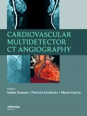 Cardiovascular Multidetector CT Angiography cover