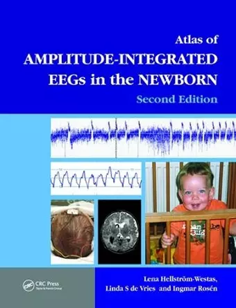 An Atlas of Amplitude-Integrated EEGs in the Newborn cover