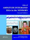 An Atlas of Amplitude-Integrated EEGs in the Newborn cover