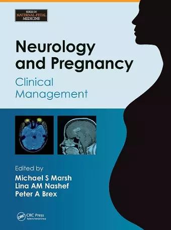 Neurology and Pregnancy cover