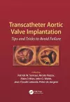 Transcatheter Aortic Valve Implantation cover