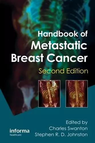 Handbook of Metastatic Breast Cancer cover