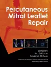 Percutaneous Mitral Leaflet Repair cover