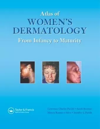 Atlas of Women's Dermatology cover