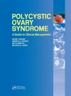 Polycystic Ovary Syndrome cover