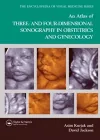 An Atlas of Three- and Four-Dimensional Sonography in Obstetrics and Gynecology cover