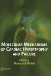 Molecular Mechanisms of Cardiac Hypertrophy and Failure cover