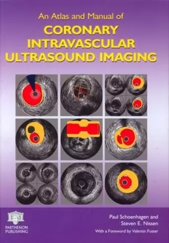 An Atlas and Manual of Coronary Intravascular Ultrasound Imaging cover