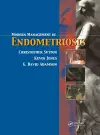 Modern Management of Endometriosis cover