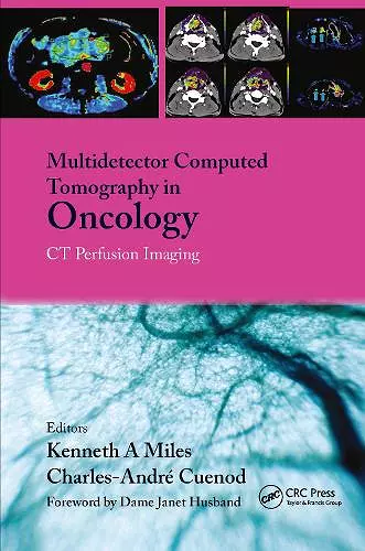 Multi-Detector Computed Tomography in Oncology cover