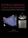 Intracardiac Echocardiography in Interventional Electrophysiology cover