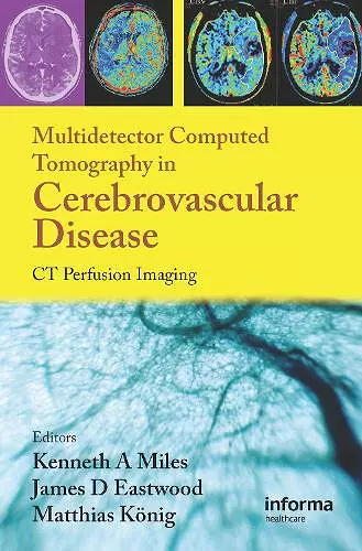 Multidetector Computed Tomography in Cerebrovascular Disease cover