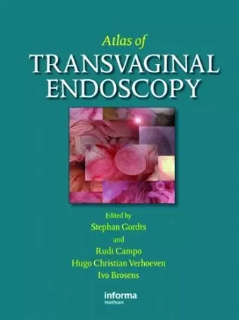 Atlas of Transvaginal Endoscopy cover