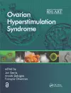 Ovarian Hyperstimulation Syndrome cover