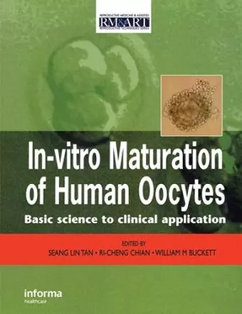 In Vitro Maturation of Human Oocytes cover