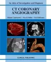CT Coronary Angiography: Atlas of Investigation and Management cover