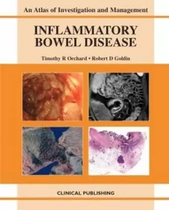 Inflammatory Bowel Disease cover