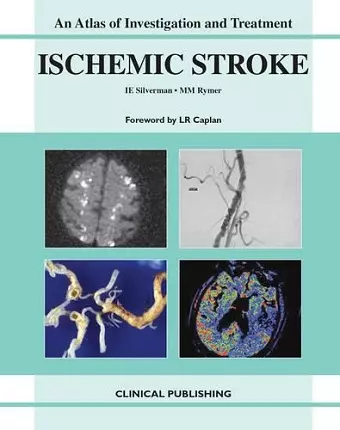 Ischemic Stroke cover