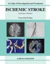 Ischemic Stroke cover