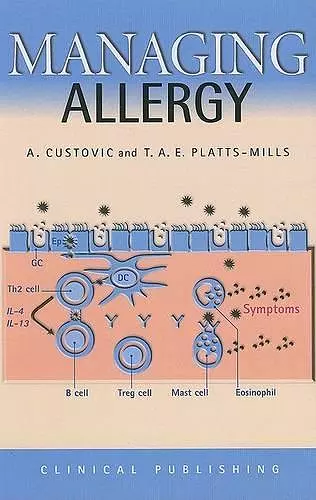 Managing Allergy cover